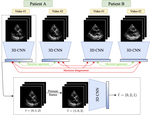 Self-Supervised Learning of Echocardiogram Videos Enables Data-Efficient Clinical Diagnosis