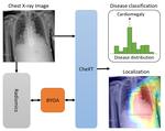 Radiomics-Guided Global-Local Transformer for Weakly Supervised Pathology Localization in Chest X-Rays