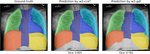Multi-class semantic segmentation of pediatric chest radiographs