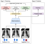 Improving Fairness of Automated Chest X-ray Diagnosis by Contrastive Learning