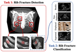 Deep Rib Fracture Instance Segmentation and Classification from CT on the RibFrac Challenge